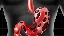 blog_ulcers | Central Coast VNA & Hospice